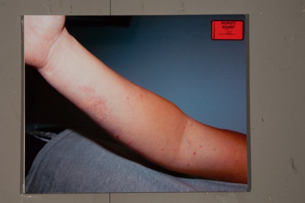 Evidence Photo