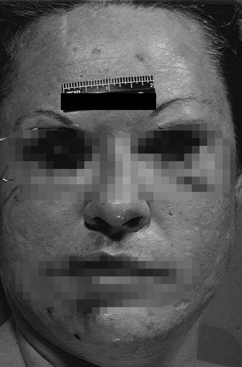 The Eyeball Killer case photo