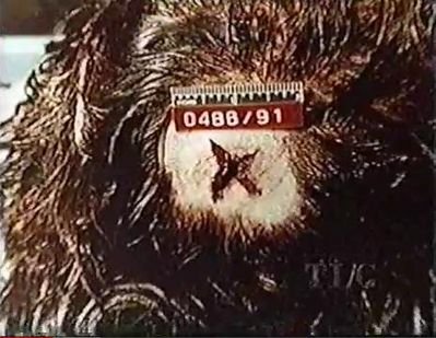 The Eyeball Killer case photo